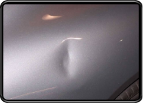 auto dent removal
