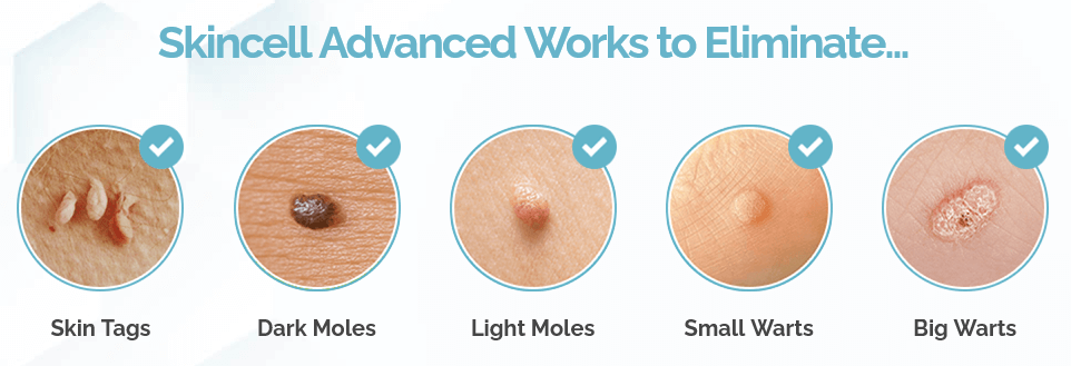 Skincell Advanced Work to Eliminate