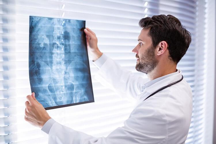 x-rays