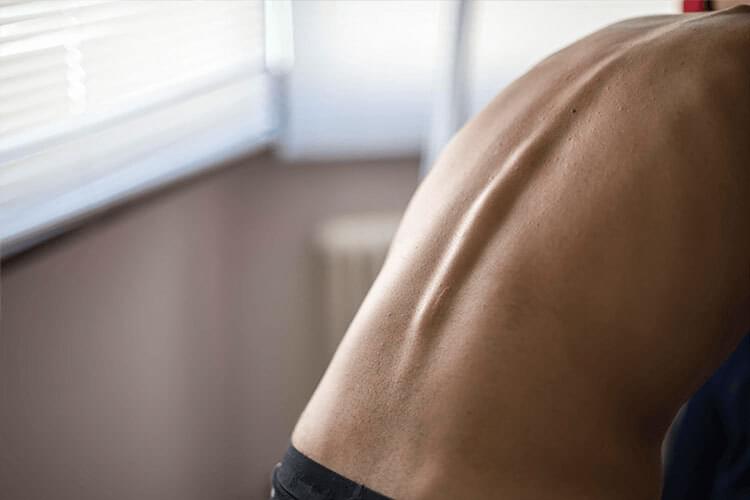 other back pain